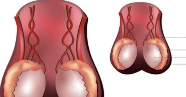 Bác sĩ lưu ý dấu hiệu đừng bỏ qua khi kiểm tra tinh hoàn