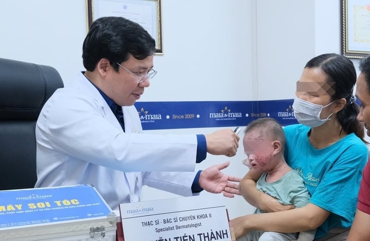 El doctor Thanh revisa la salud de un niño con dermatitis atópica. (Foto: BSCC)