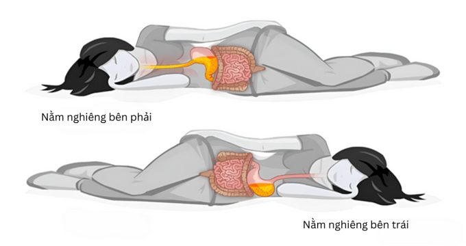 Điểm khác biệt giữa hai tư thế nằm. Ảnh: Gastrointestinal Society