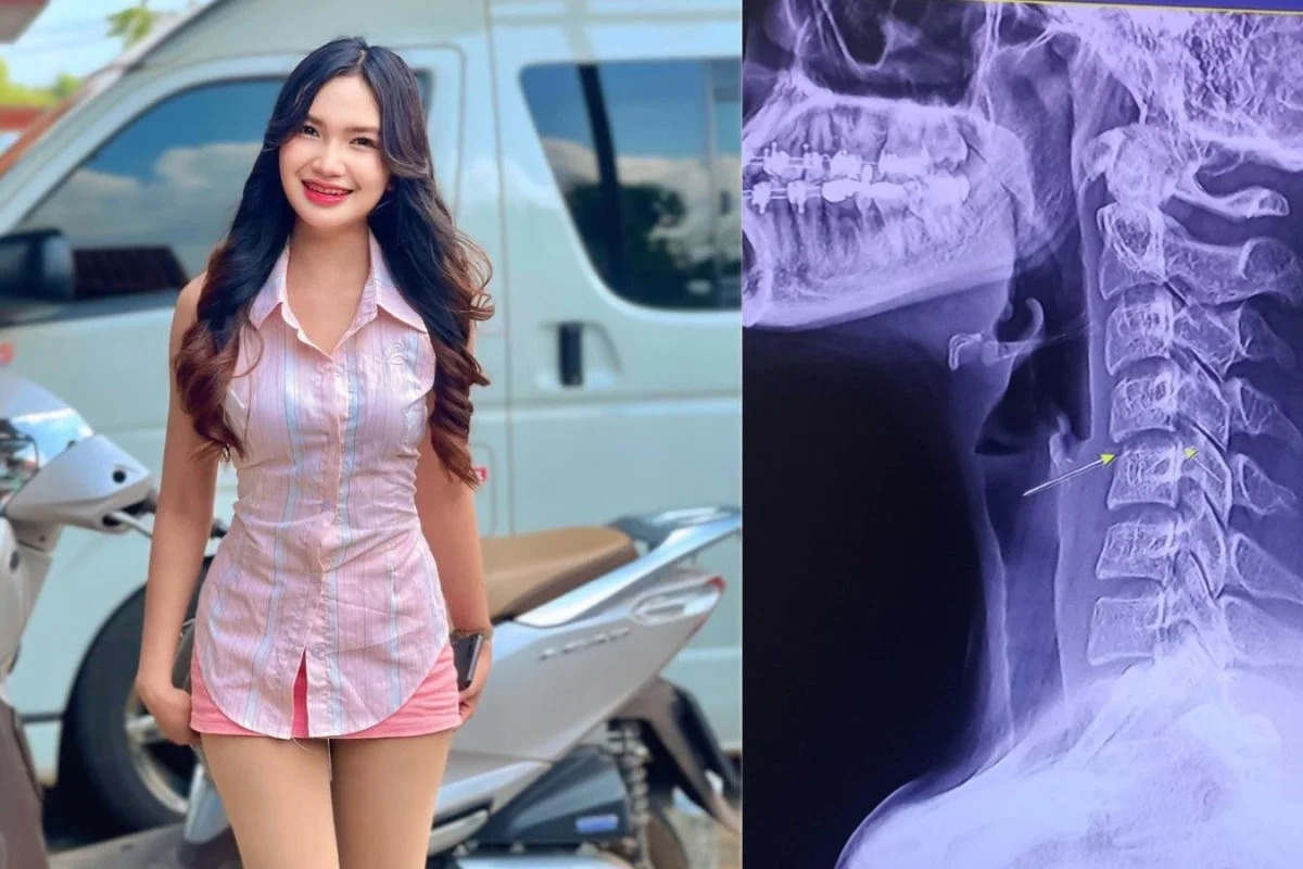 The dangers of massage therapy still exist after the death of a young Thai singer, picture 1