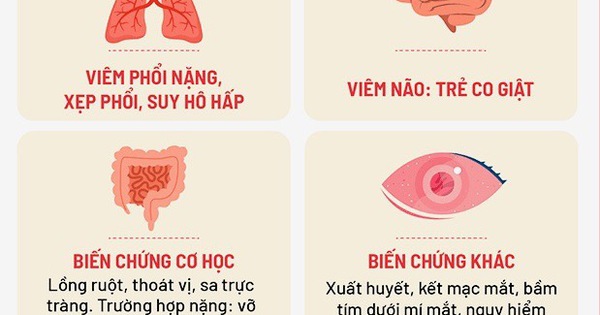 Aumentan los casos de tos ferina en Hanoi