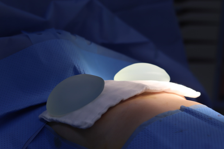 Image of breast implants after removal from the body.