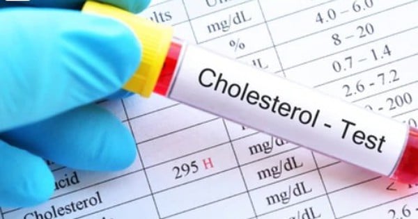 Chuyên gia chia sẻ 4 món ăn sáng giúp giảm cholesterol