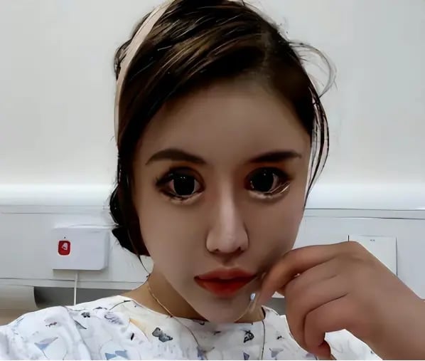 Cô gái nghiện làm đẹp từ năm 13 tuổi, chi 14 tỷ đồng để phẫu thuật thẩm mỹ, hiện tại hối hận nhưng đã muộn màng - Ảnh 5.