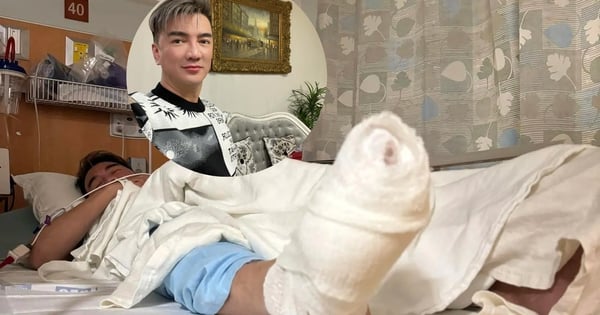 Mr. Dam postponed his live show because he fell from a height while performing in the US.