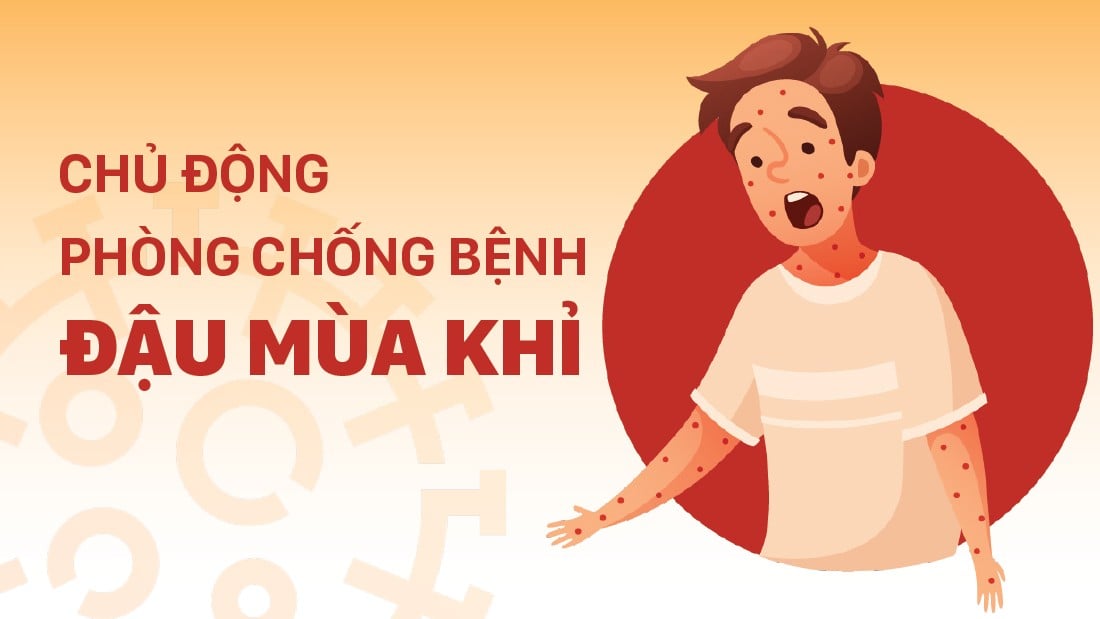 Chủ động phòng chống bệnh đậu mùa khỉ