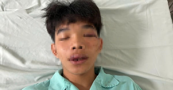 Un estudiante de secundaria fue golpeado frente a la puerta de la escuela en Binh Phuoc.