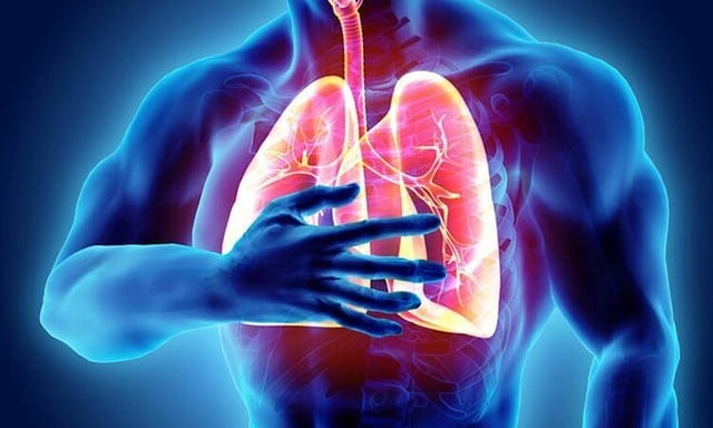 Bé 13 tuổi ở Quảng Ninh nổi mụn chi chít vì tự uống thuốc long đờm, đây là biến chứng đáng sợ nhiều người không biết  - Ảnh 4.