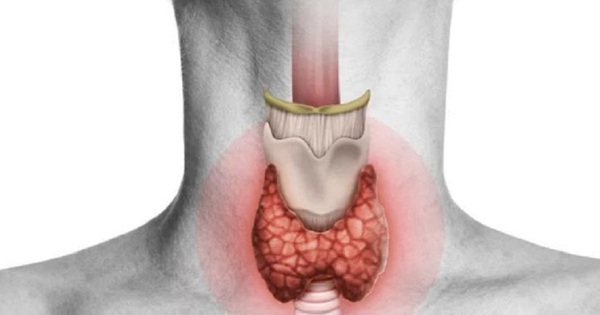 Persistent diarrhea can be a warning sign of thyroid cancer