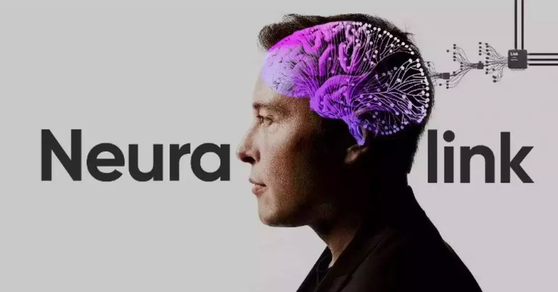 Neuralink implanta un chip en el cerebro humano: ¿Un gran avance o una exageración?