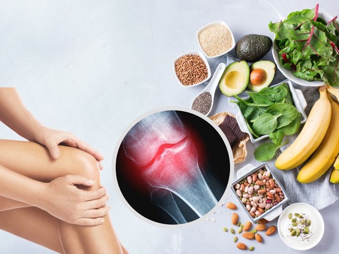 5 Nährstoffe, die neben Kalzium gut für Knochen und Gelenke sind