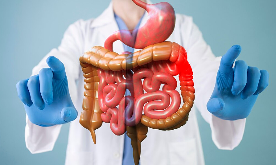 6 common intestinal diseases