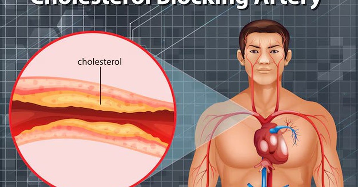 Top thực phẩm giúp giảm cholesterol cao