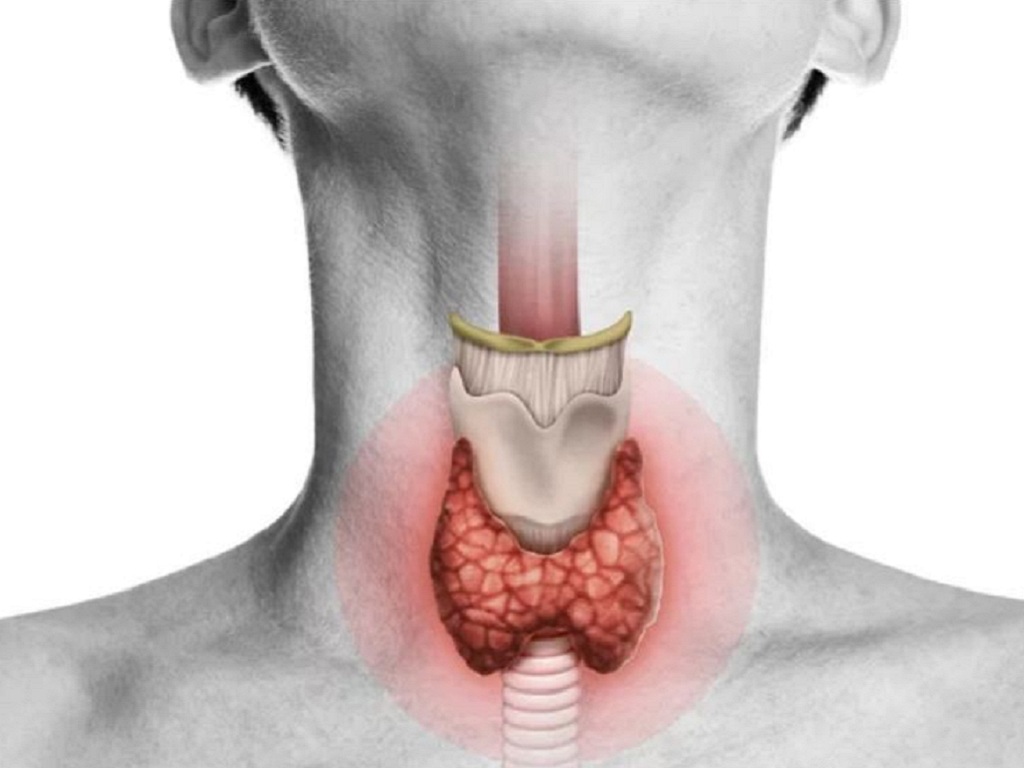 Tiêu chảy kéo dài: khi nào là dấu hiệu cảnh báo ung thư tuyến giáp ? - Ảnh 1.