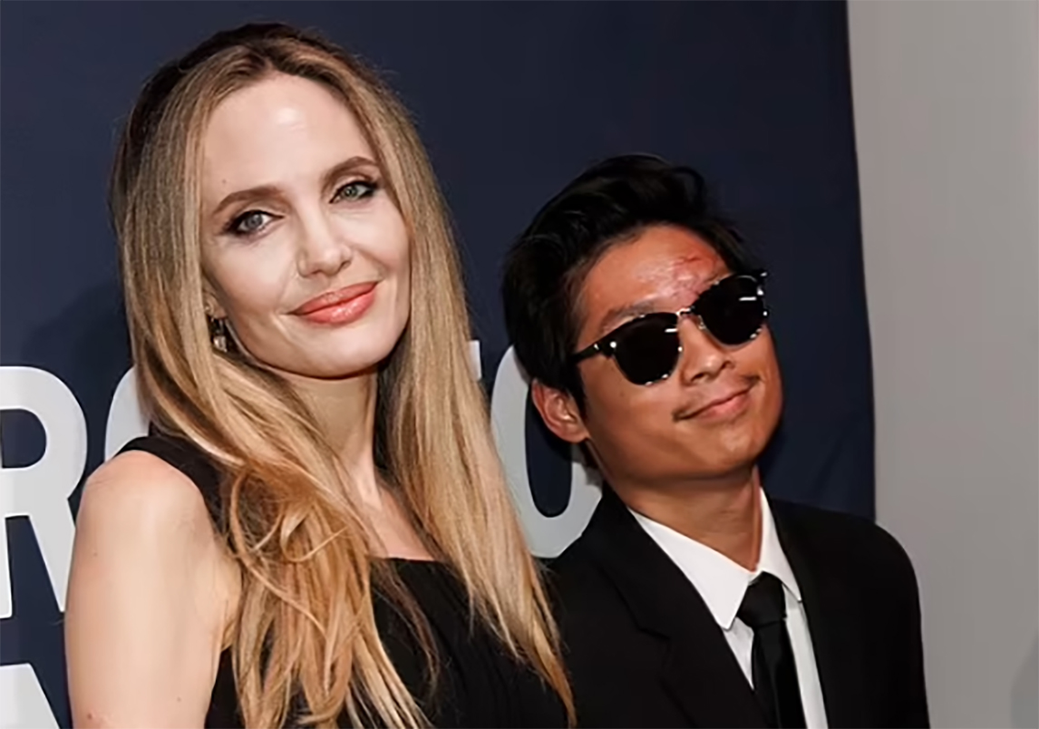 Angelina Jolie tìm bác sĩ thẩm mỹ hàng đầu chữa vết sẹo cho Pax Thiên- Ảnh 1.