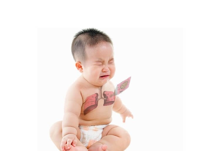 Pneumonie persistante récurrente chez l'enfant, comment la prévenir ?