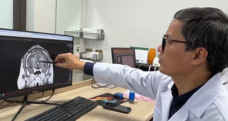 기적의 수술로 21년간 고통받은 간질 발작이 90% 감소