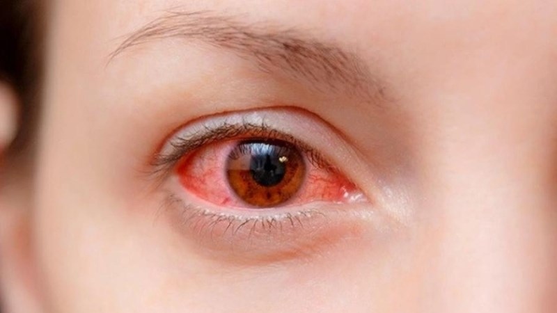 common diseases when the weather turns cold picture 2
