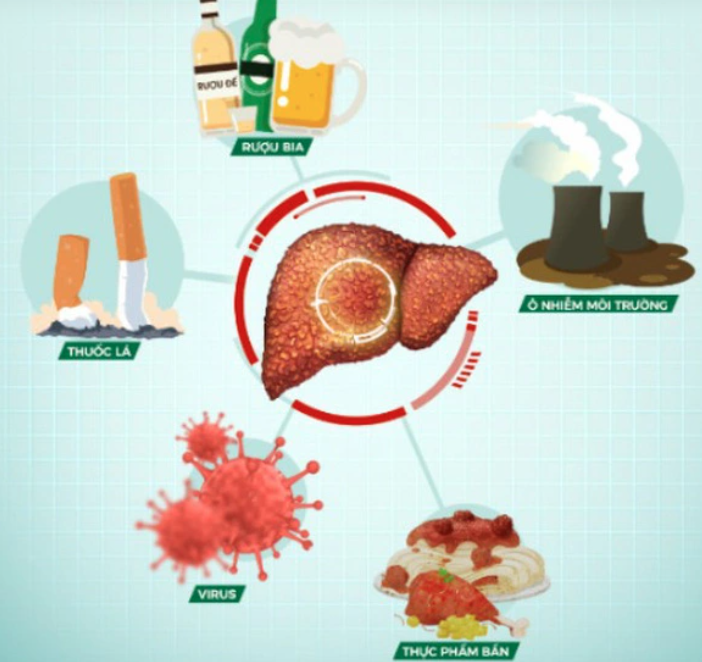 Các tác nhân gây tổn thương gan - Ảnh minh họa