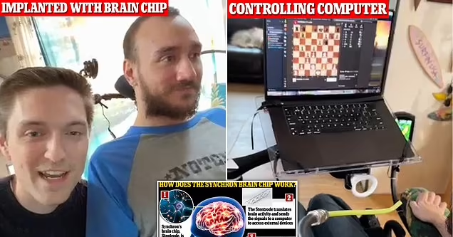 Un paciente con chip cerebral Neuralink juega al ajedrez en un ordenador portátil