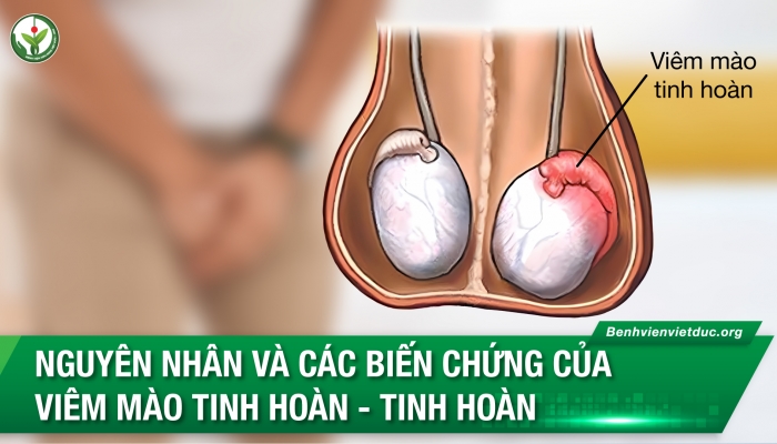 Bác sĩ tiết lộ lý do bệnh lý khiến nhiều quý ông suy giảm chức năng đàn ông