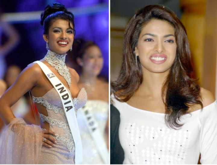 Miss Mundo deprimida por cirugía plástica fallida - 1