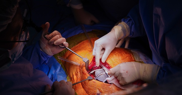 Vinmec performs thoracic reconstruction surgery using titanium using 3D printing technology