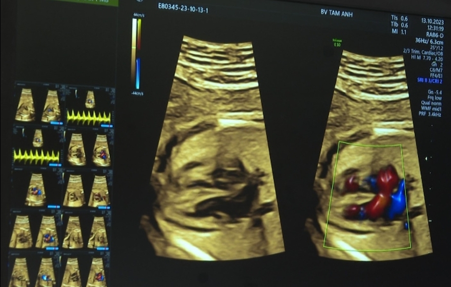 technologie qui sauve les enfants des malformations congénitales dans l'utérus image 4