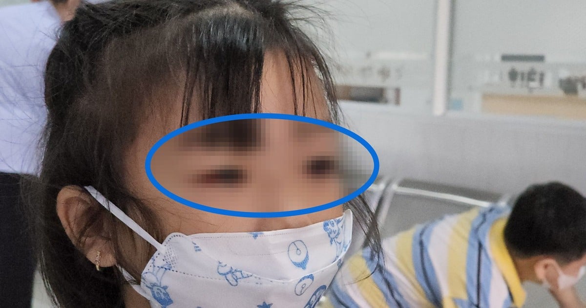 HCMC: The agent causing pink eye disease has been identified