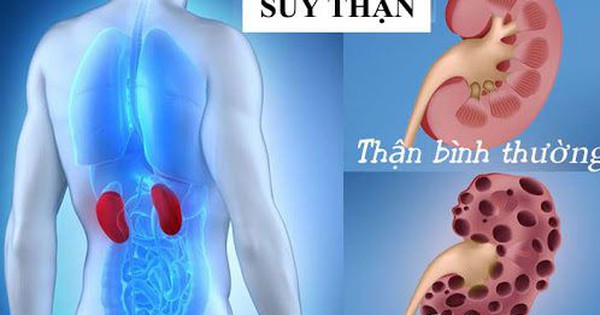 Có 3 dấu hiệu này, thanh niên ở Phú Thọ đi khám bàng hoàng phát hiện suy thận giai đoạn cuối