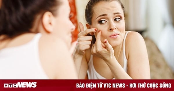 Vì sao mặt tự nhiên nổi nhiều mụn trứng cá?