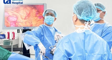 Surgery to remove hundreds of malignant colon polyps, completely eradicate cancer