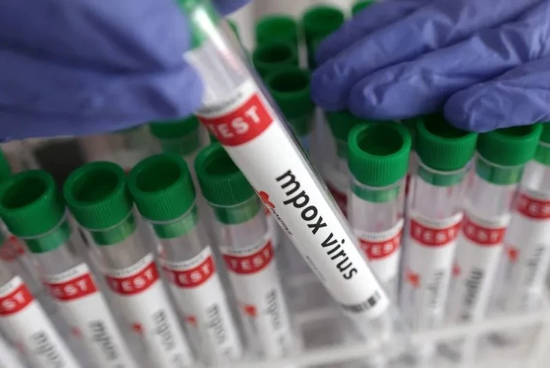 Sample tested for monkeypox virus. Photo: REUTERS