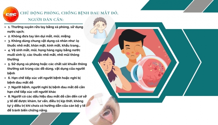 Lào Cai: Khẩn trương dập tắt 16 ổ dịch đau mắt đỏ