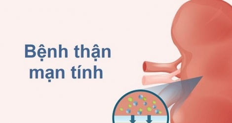 Đề xuất thêm một số bệnh vào Chiến lược quốc gia bệnh không lây nhiễm