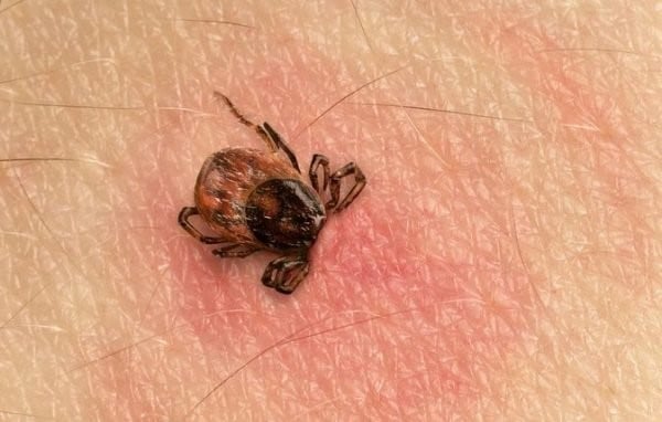 お腹の痛みは10日以上続きました（写真1）。