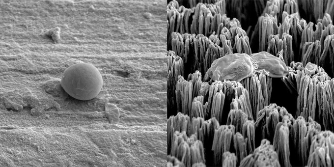 Una célula de Candida intacta sobre una superficie de titanio pulido (izquierda) y una célula de Candida rota sobre una superficie de titanio con micropúas (derecha).