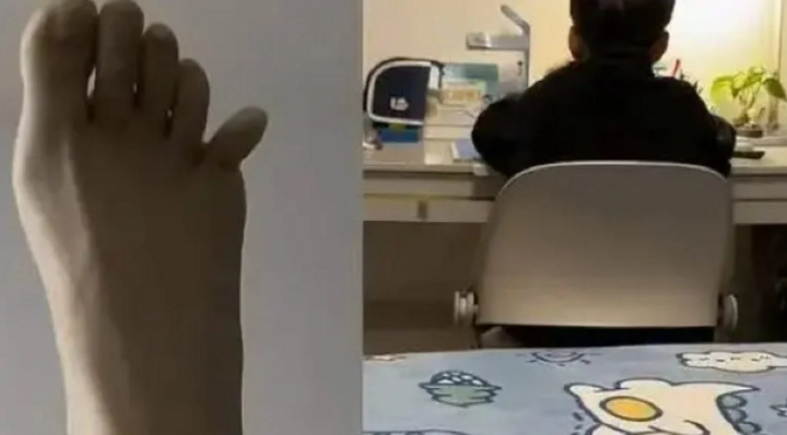 Ms. Zhang kicked the wall so hard that her little toe broke. (Photo: Baidu)