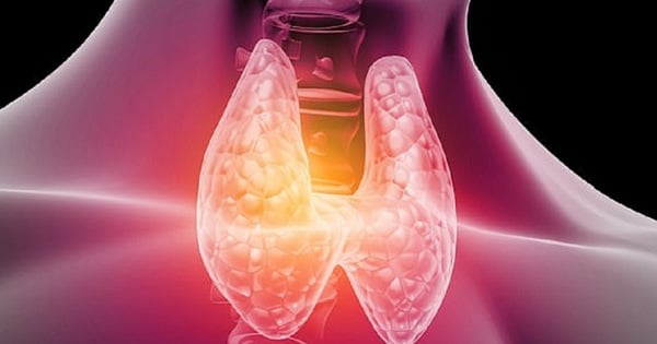 早期発見が必要な4つの一般的な甲状腺疾患