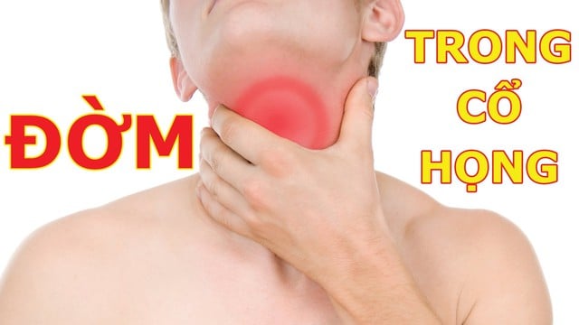 Bé 13 tuổi ở Quảng Ninh nổi mụn chi chít vì tự uống thuốc long đờm, đây là biến chứng đáng sợ nhiều người không biết  - Ảnh 5.