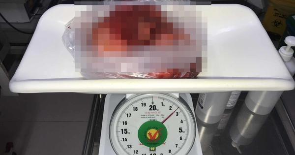 2.5 kg tumor in man's chest