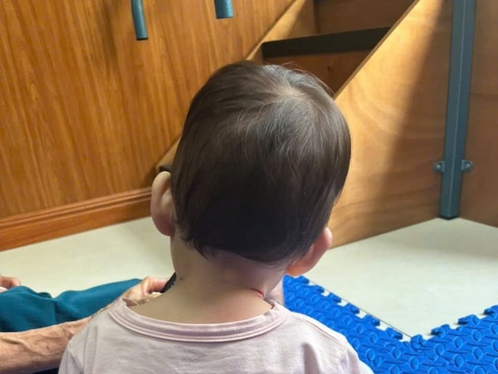 Kinder mit Schiefhals. (Foto: BSCC)