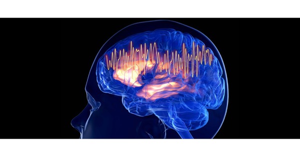 La estimulación eléctrica cerebral en casa podría ayudar a tratar la depresión