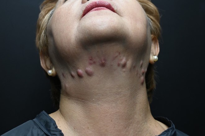 La douleur de devoir faire face aux complications liées aux soins de beauté dans des spas illégaux et sans licence