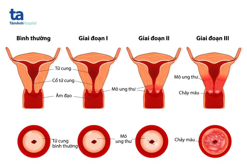 Đề xuất mở rộng quyền lợi cho người tham gia bảo hiểm y tế  - Ảnh 1.