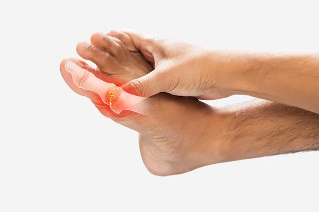 Mẹo hay để kiểm soát bệnh gout trong những ngày tết- Ảnh 3.