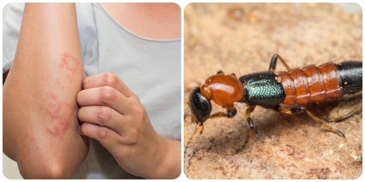 Un moyen simple et efficace pour tuer les fourmis dans les appartements - 1