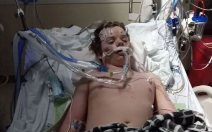 13-year-old boy dies after following TikTok challenge