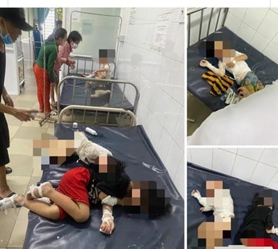 Tay Ninh a transféré à l'hôpital 4 enfants brûlés après avoir été pris au piège dans un incendie