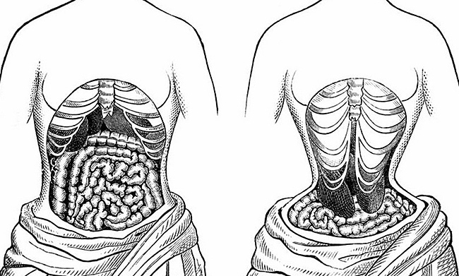 Принудительное подтягивание талии и сжигание жира с помощью корсета